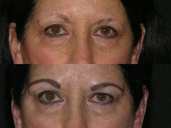 Eyeliner, Lip, and Eyebrow Tattooing case #42855
